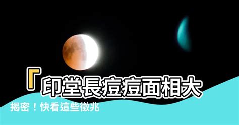 印堂長痘痘面相|發大財五大徵兆快看！命理師：眉毛耳朵長痘痘、印堂鼻子發亮財。